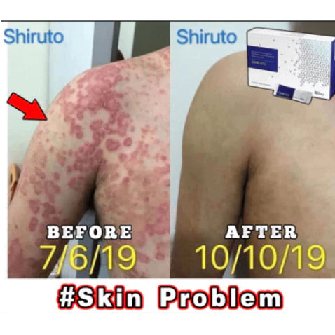 BElixz SHIRUTO Enhance and repair human immune system, and relieve various skin diseases