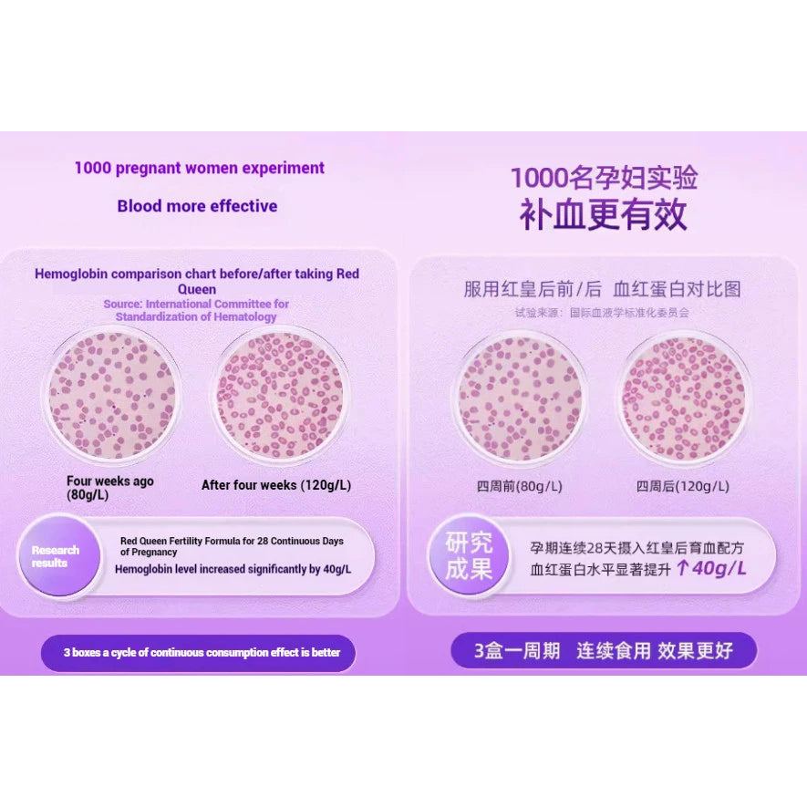 【buy 3 free 1】exp2026.06 Ferrolip FORTE Iron Supplement Compound Vitamin Supplement Iron-supplement